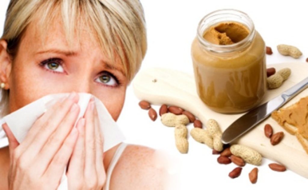 Пищевая аллергия у детей и взрослых: типы, причины, профилактика