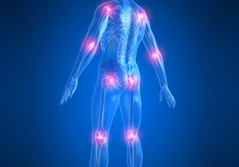 Артралгия (боль в суставах) признаки, симптомы и лечение