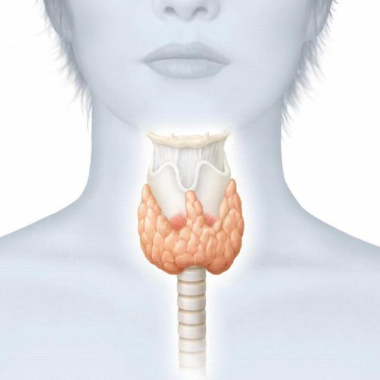 Как выглядит шея при щитовидке фото