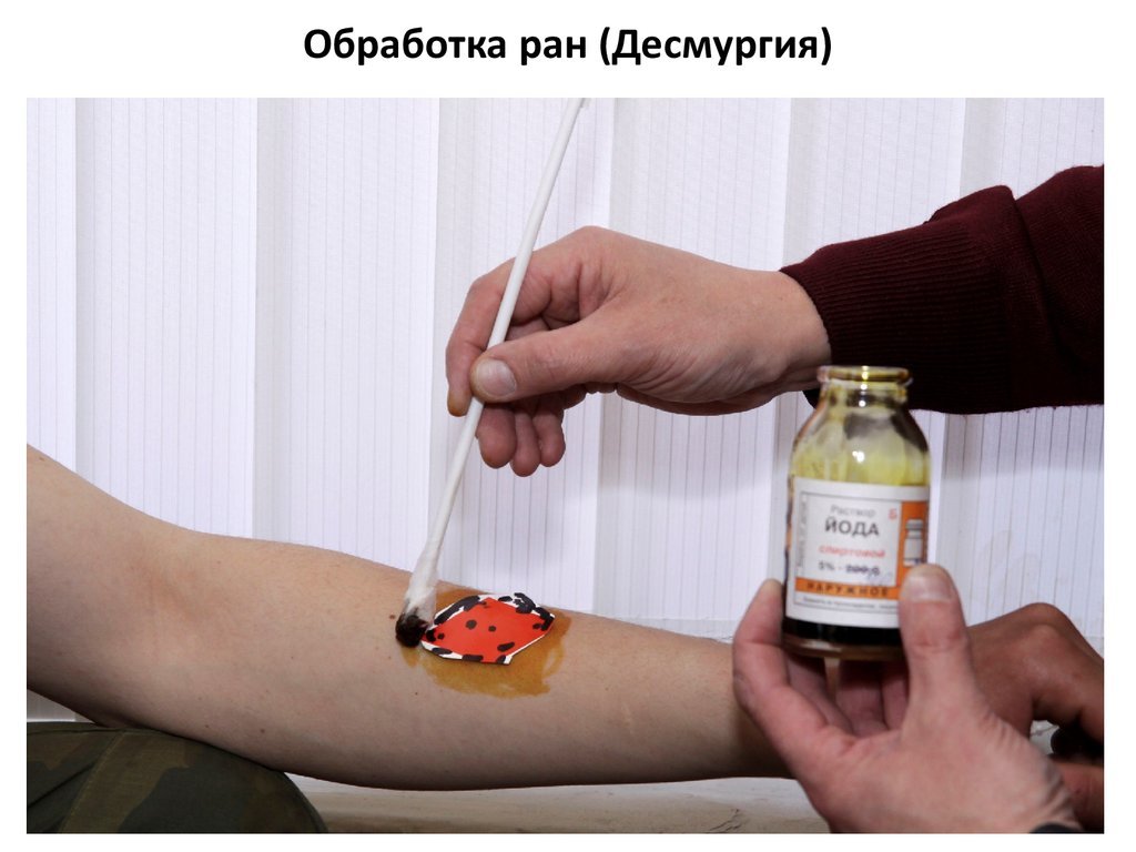Рана на коже обработка раны на поверхности кожи
