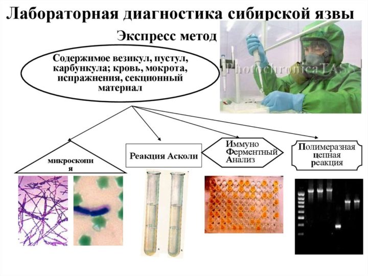 Презентация на тему сибирская язва