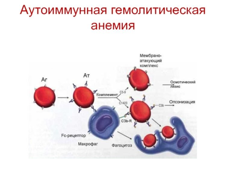 Гемолитическая анемия презентация по терапии