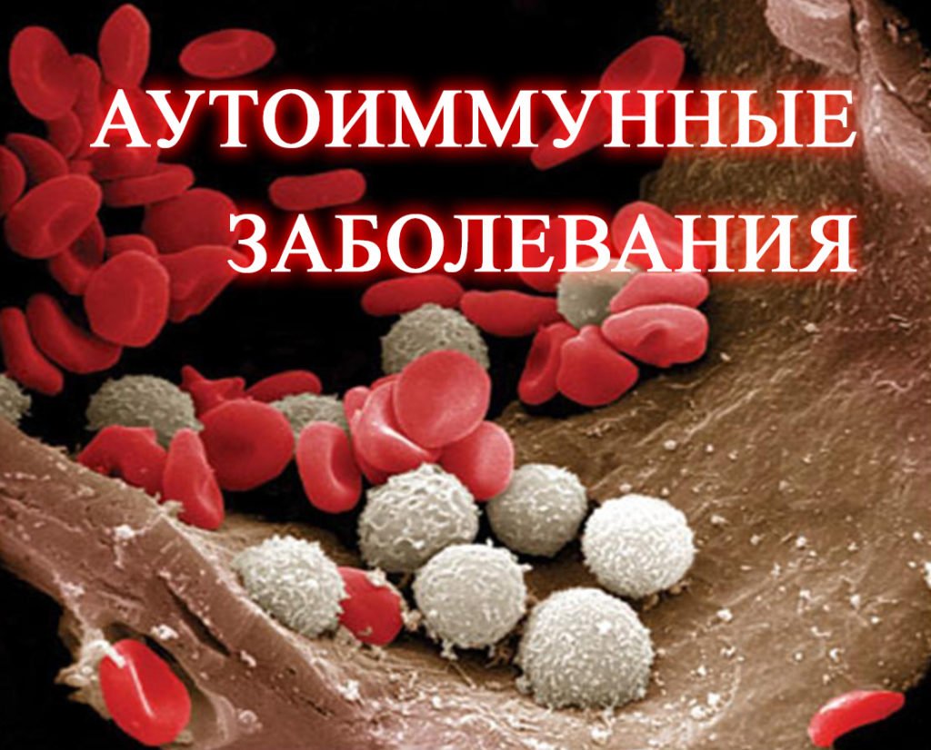 Аутоиммунные заболевания симптомы и признаки, список