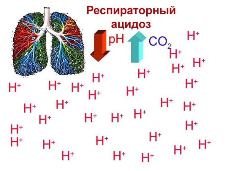 Метаболический ацидоз картинки