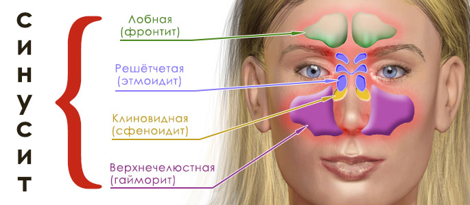 Боль в носовых пазухах причины, симптомы и лечение