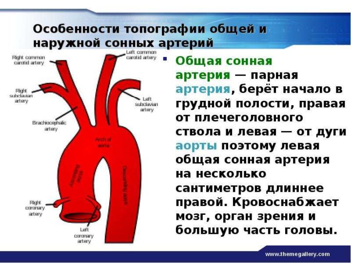 Общая сонная артерия схема