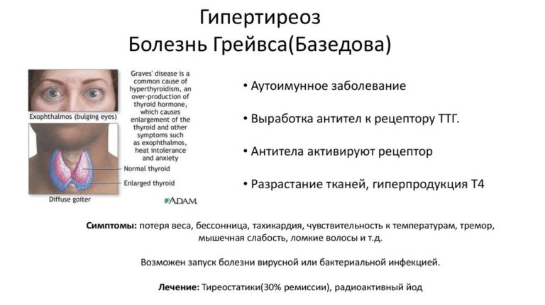 Болезнь Грейвса признаки, причины и лечение